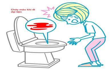 Chảy máu khi đi đại tiện có phải bị bệnh trĩ không?