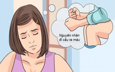 Giúp bạn tìm hiểu nguyên nhân đi cầu ra máu 