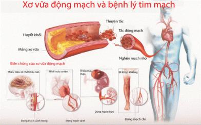 Đáng lo ngại với các biến chứng đại tiện khó 
