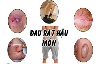 5 biểu hiện áp xe hậu môn thường gặp nhất