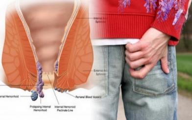 Bị ngứa hậu môn sau sinh có sao không