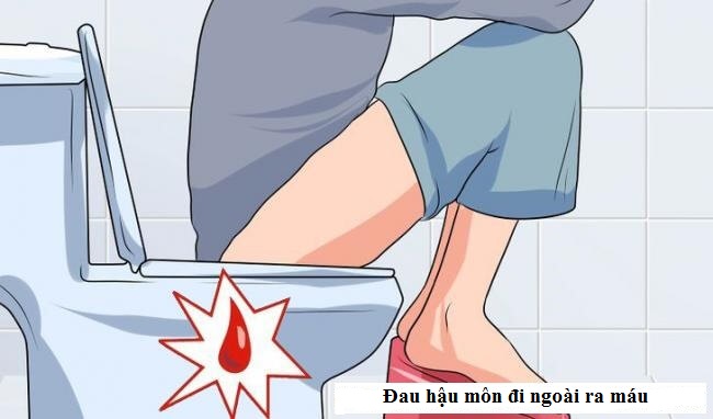 Đau hậu môn đi ngoài ra máu