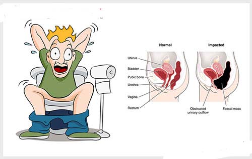 Đi cầu ra máu cục