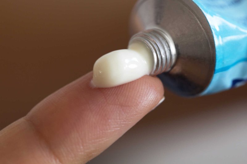 Ngứa hậu môn bôi thuốc gì