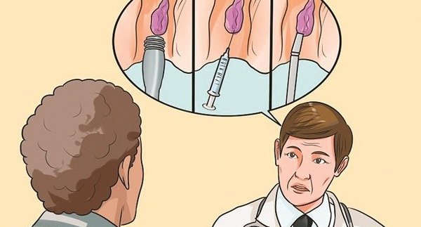 Mổ rò hậu môn có đau không